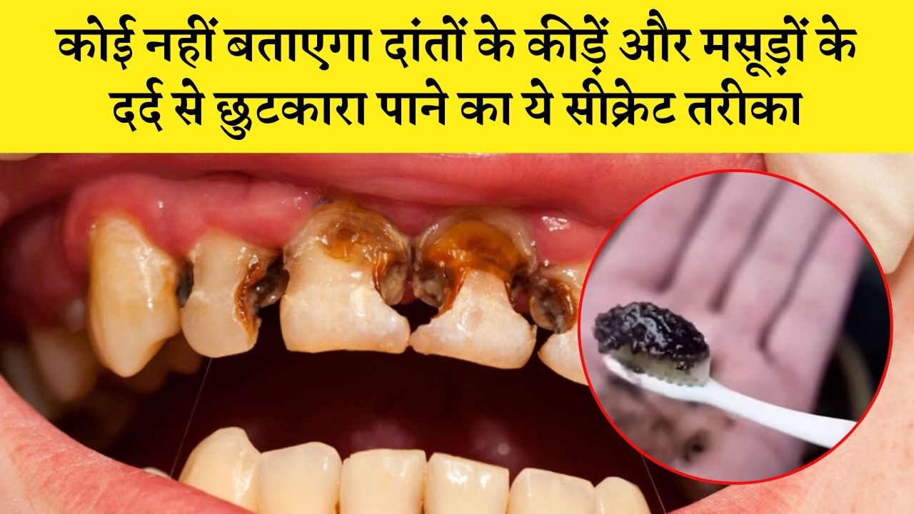 कोई नहीं बताएगा दांतों के कीड़ें और मसूड़ों के दर्द से छुटकारा पाने का ये सीक्रेट तरीका